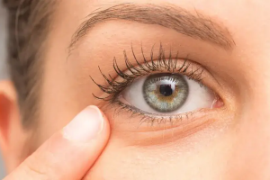 Preventing Under-Eye Wrinkles: Steps to Maintain Youthful Skin