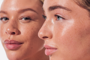 Hydration vs. Moisturization: A Dermatologist Explains the Difference