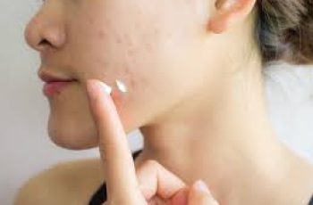 Can You Use Azelaic Acid Daily for Six Months?