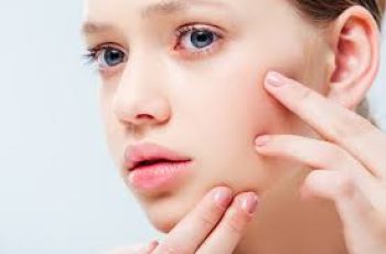 How Long Does Acne Take to Heal With Proper Skincare?