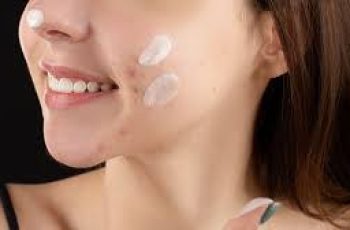 Treating Open Acne Spots Safely with Niacinamide in Skincare