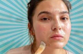 Cheek Acne Causes and Home Remedies: Effective Tips for Clearer Skin
