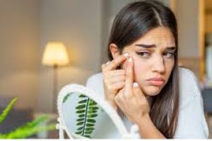 Say Goodbye to Breakouts: Non-Comedogenic Skincare That Works
