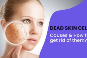 Dead Skin Cells: Causes, Effects, and How to Remove Them for Smoother Skin