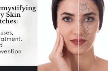 Scaly Skin Patches: Causes, Treatments, and Skincare Solutions