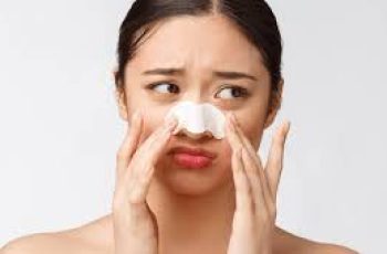 The Ultimate Guide to Blackheads: Prevention, Removal, and Treatment