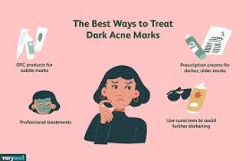 How Inflammation Triggers Hyperpigmentation and Ways to Protect Skin How Inflammation Triggers Hyperpigmentation and Ways to Protect Skin