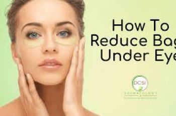 Skincare Tips to Treat and Prevent Under-Eye Bags Naturally