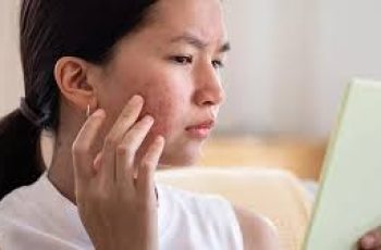 Proven Skincare Routine to Clear Acne Naturally at Home