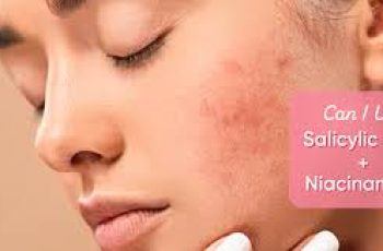 Pairing Niacinamide and Salicylic Acid for Clearer, Balanced Skin Pairing Niacinamide and Salicylic Acid for Clearer, Balanced Skin