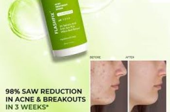 Salicylic Acid Routine for Acne: Tips, Frequency, and Benefits Salicylic Acid Routine for Acne: Tips, Frequency, and Benefits