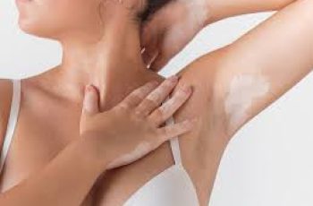 4 Expert Tips for Achieving Smooth and Healthy Underarms