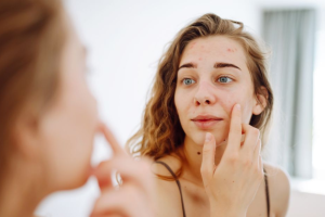 Your Guide to Comedogenic Ingredients and Clear Skin Routine
