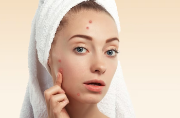 Fresh Skin in Miami’s Fall: Stop Oil, Sweat, Breakouts Fresh Skin in Miami’s Fall: Stop Oil, Sweat, Breakouts