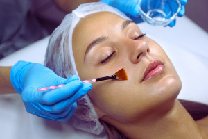 The “Healing” Mistake Ruining Your Chemical Peel: 3 Things Dermatologists Beg You to Do